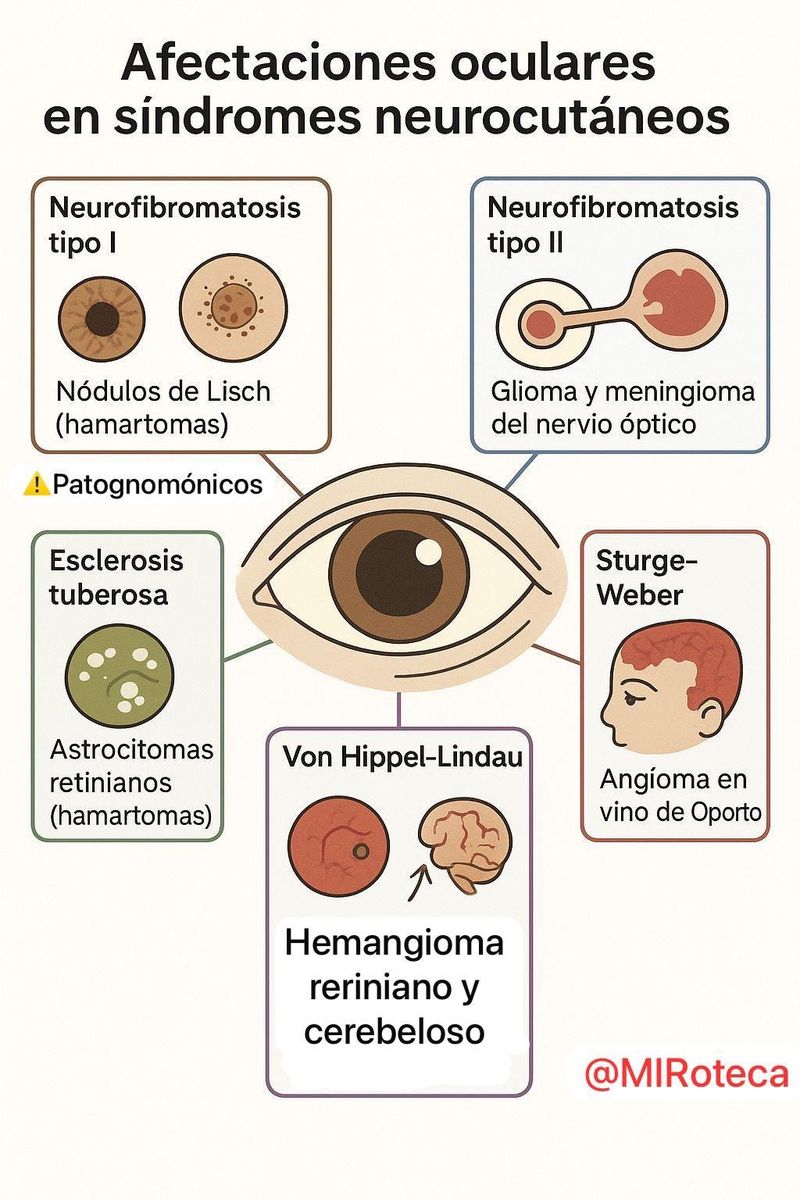 Afectación ocular en síndromes neurocutáneos