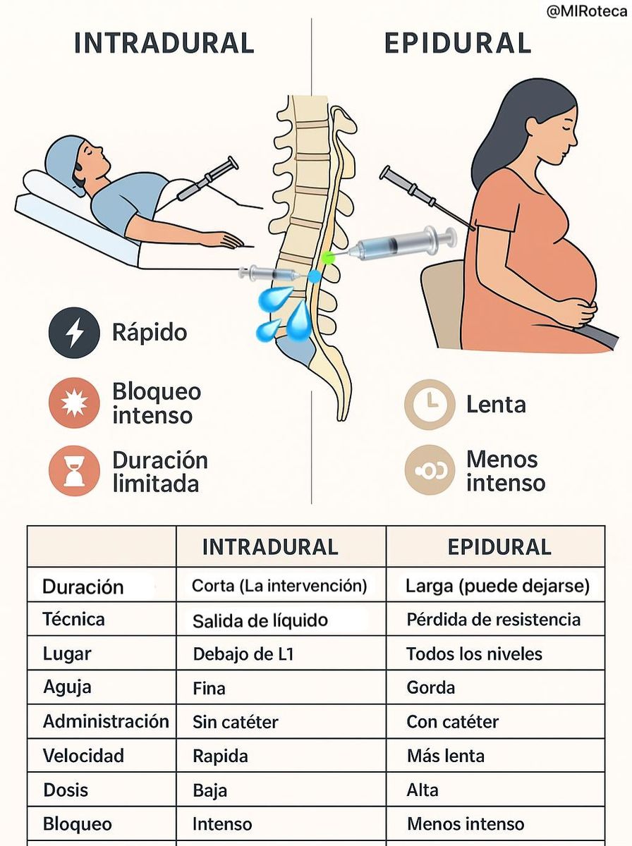 Anestesia intradural vs epidural