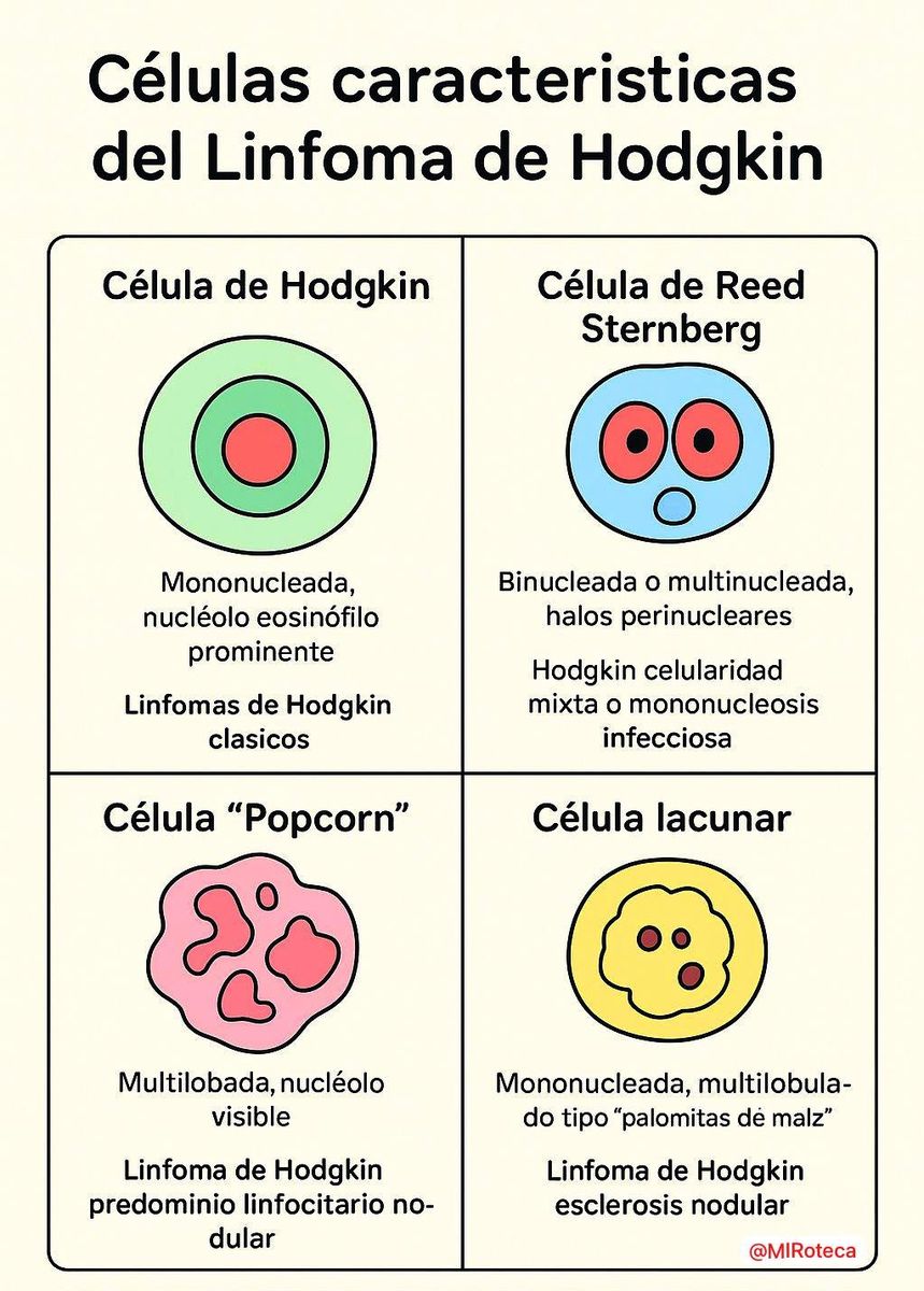 Células del linfoma de Hodgkin